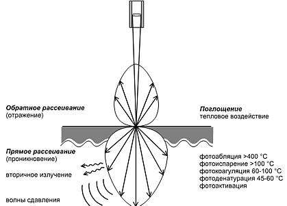 На рисунке представлены эффекты высокоинтенсивного лазерного излучения на биологические ткани где