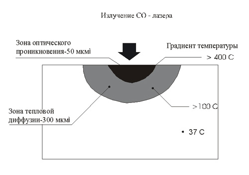 На рисунке представлены эффекты высокоинтенсивного лазерного излучения на биологические ткани где